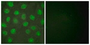 Anti-Retinoid X Receptor &#947; antibody produced in rabbit affinity isolated antibody