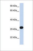 Anti-PDGFB antibody produced in rabbit affinity isolated antibody