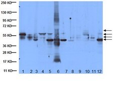 Anti-Cytokeratin AE1/AE3 Antibody, recognizes acidic &amp; basic cytokeratins, clone AE1/AE3 clone AE1/AE3, Chemicon&#174;, from mouse