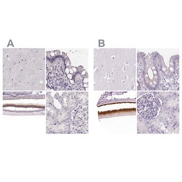 Anti-IMPG1 antibody produced in rabbit Prestige Antibodies&#174; Powered by Atlas Antibodies, affinity isolated antibody