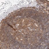 Anti-CSK antibody produced in rabbit Prestige Antibodies&#174; Powered by Atlas Antibodies, affinity isolated antibody, buffered aqueous glycerol solution