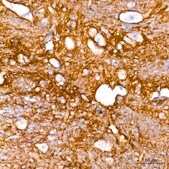 Anti-EAAT1/SLC1A3 Antibody, clone 7Y4U5, Rabbit Monoclonal