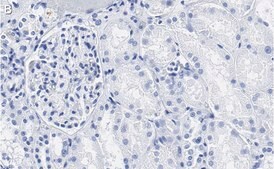Anti-PEDF (SERPIN F1) Antibody, clone 2C16 ZooMAb&#174; Rabbit Monoclonal recombinant, expressed in HEK 293 cells