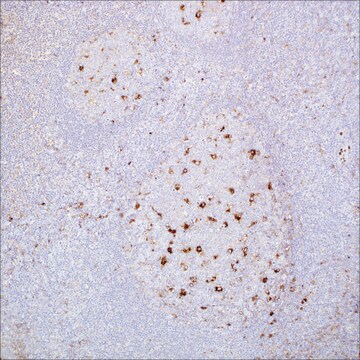 A-1-Antitrypsin Rabbit Polyclonal Antibody