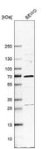Anti-NR1H3 antibody produced in rabbit Prestige Antibodies&#174; Powered by Atlas Antibodies, affinity isolated antibody, buffered aqueous glycerol solution