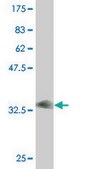 Monoclonal Anti-FXYD2 antibody produced in mouse clone 1C3-B3, purified immunoglobulin, buffered aqueous solution