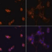 Anti-LC3B antibody produced in rabbit