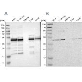 Anti-UQCRC2 antibody produced in rabbit Prestige Antibodies&#174; Powered by Atlas Antibodies, affinity isolated antibody, buffered aqueous glycerol solution