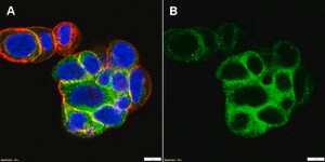 Anti-PKA C-&#945; Antibody, clone 2E17 ZooMAb&#174; Rabbit Monoclonal recombinant, expressed in HEK 293 cells