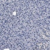 Anti-KCNC3 antibody produced in rabbit Prestige Antibodies&#174; Powered by Atlas Antibodies, affinity isolated antibody, buffered aqueous glycerol solution