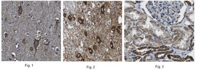 Anti-ABCA1 Antibody, clone MABI98-7 clone MAB198-7, from rat