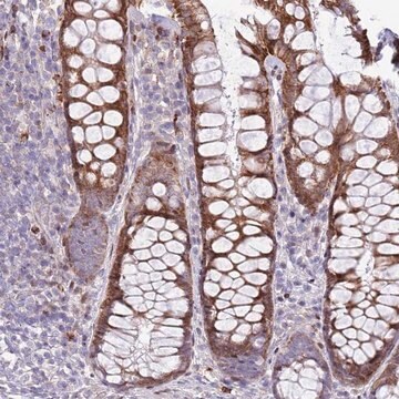 Anti-ANO8 antibody produced in rabbit Prestige Antibodies&#174; Powered by Atlas Antibodies, affinity isolated antibody, buffered aqueous glycerol solution