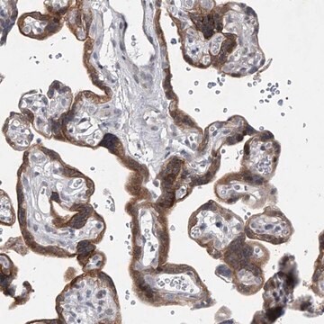 Anti-HEATR6 antibody produced in rabbit Prestige Antibodies&#174; Powered by Atlas Antibodies, affinity isolated antibody, buffered aqueous glycerol solution