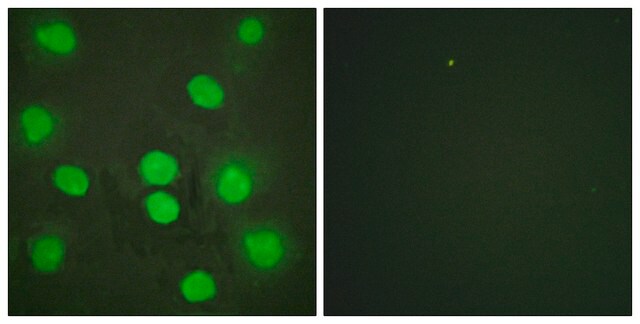 Anti-GATA4 antibody produced in rabbit affinity isolated antibody