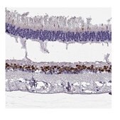 Anti-VSX2 antibody produced in rabbit Prestige Antibodies&#174; Powered by Atlas Antibodies, affinity isolated antibody, buffered aqueous glycerol solution