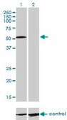 Monoclonal Anti-IL13RA2 antibody produced in mouse clone 2E10, purified immunoglobulin, buffered aqueous solution