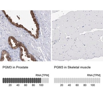 Anti-PGM3 antibody produced in rabbit Prestige Antibodies&#174; Powered by Atlas Antibodies, affinity isolated antibody, buffered aqueous glycerol solution, ab1