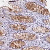 Anti-REG4 antibody produced in rabbit Prestige Antibodies&#174; Powered by Atlas Antibodies, affinity isolated antibody, buffered aqueous glycerol solution