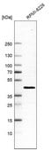 Anti-PREB antibody produced in rabbit Prestige Antibodies&#174; Powered by Atlas Antibodies, affinity isolated antibody, buffered aqueous glycerol solution