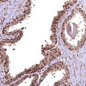 Anti-GAPDH antibody produced in rabbit Prestige Antibodies&#174; Powered by Atlas Antibodies, affinity isolated antibody, buffered aqueous glycerol solution
