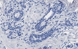 Anti-IGF-1R β Antibody, clone 1D18 ZooMAb&#174; Rabbit Monoclonal recombinant, expressed in HEK 293 cells