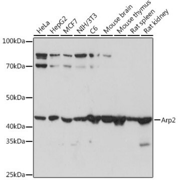 Anti-Arp2 Antibody, clone 6B1I3, Rabbit Monoclonal