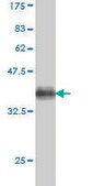 Monoclonal Anti-SLC9A1 antibody produced in mouse clone 2F5, purified immunoglobulin, buffered aqueous solution