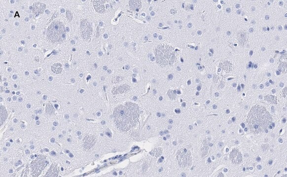 Anti-Tyrosine Hydroxylase Antibody, clone 3M12, ZooMAb&#174; Rabbit Monoclonal recombinant, expressed in HEK 293 cells