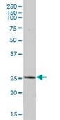 Anti-ETHE1 antibody produced in mouse IgG fraction of antiserum, buffered aqueous solution