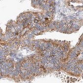 Anti-TSPOAP1 antibody produced in rabbit Prestige Antibodies&#174; Powered by Atlas Antibodies, affinity isolated antibody, buffered aqueous glycerol solution, Ab1