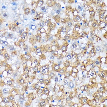 Anti-Casein Kinase 1 alpha (CSNK1A1) Antibody, clone 9O4L9, Rabbit Monoclonal