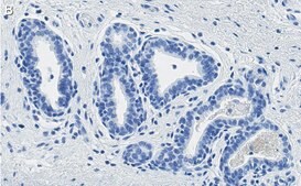 Anti-PTEN Antibody, clone 6B12 ZooMAb&#174; Rabbit Monoclonal recombinant, expressed in HEK 293 cells