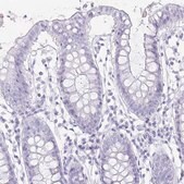 Anti-TNNT1 antibody produced in rabbit Prestige Antibodies&#174; Powered by Atlas Antibodies, affinity isolated antibody, buffered aqueous glycerol solution