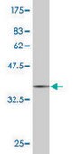 Monoclonal Anti-NFE2L2 antibody produced in mouse clone 2G7, purified immunoglobulin, buffered aqueous solution