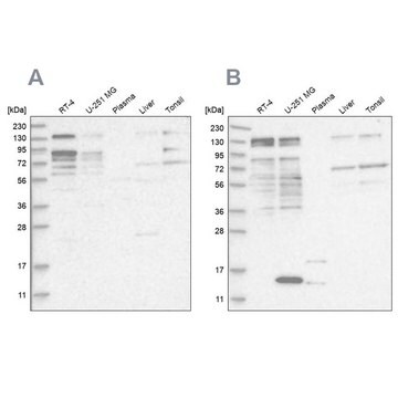 Anti-PUM1 antibody produced in rabbit Prestige Antibodies&#174; Powered by Atlas Antibodies, affinity isolated antibody