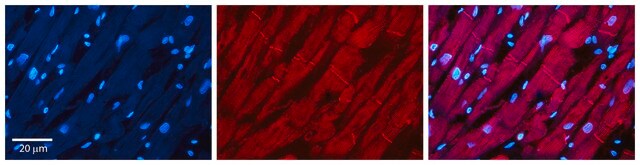 Anti-POLB antibody produced in rabbit affinity isolated antibody