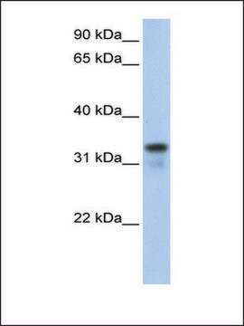 Anti-GLYATL2 antibody produced in rabbit affinity isolated antibody