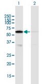 Anti-CAT antibody produced in mouse purified immunoglobulin, buffered aqueous solution