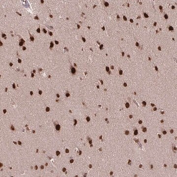 Anti-SS18 antibody produced in rabbit Prestige Antibodies&#174; Powered by Atlas Antibodies, affinity isolated antibody, buffered aqueous glycerol solution