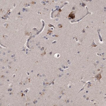 Anti-KLHDC3 antibody produced in rabbit Prestige Antibodies&#174; Powered by Atlas Antibodies, affinity isolated antibody, buffered aqueous glycerol solution, ab2