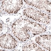 Monoclonal Anti-PIK3CB antibody produced in mouse Prestige Antibodies&#174; Powered by Atlas Antibodies, clone CL9518, purified immunoglobulin, buffered aqueous glycerol solution