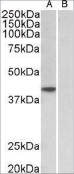 Anti-TBP antibody produced in goat affinity isolated antibody, buffered aqueous solution