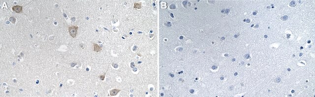 Anti-MBNL1 Antibody, clone 1H11 ZooMAb&#174; Rabbit Monoclonal recombinant, expressed in HEK 293 cells