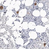 Anti-ITGA2B antibody produced in rabbit Prestige Antibodies&#174; Powered by Atlas Antibodies, affinity isolated antibody, buffered aqueous glycerol solution