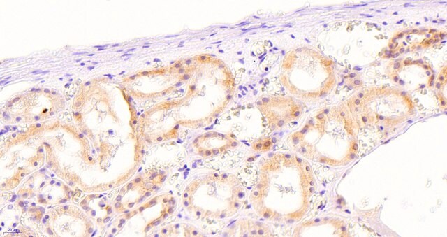 Anti-NOX1 antibody produced in goat affinity isolated antibody, buffered aqueous solution