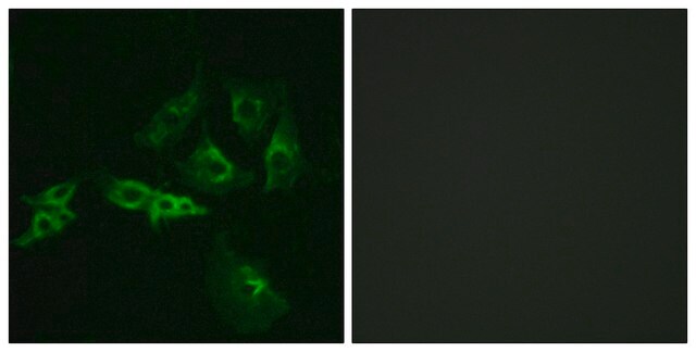 Anti-GNRHR antibody produced in rabbit affinity isolated antibody