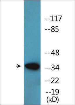 Anti-phospho-c-Jun (pTyr170) antibody produced in rabbit affinity isolated antibody