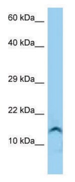 Anti-GUCA2A antibody produced in rabbit affinity isolated antibody