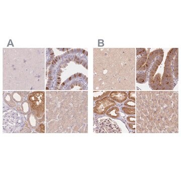 Anti-WDR54 antibody produced in rabbit Prestige Antibodies&#174; Powered by Atlas Antibodies, affinity isolated antibody, buffered aqueous glycerol solution