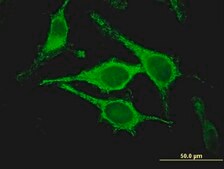 Monoclonal Anti-CLIC5 antibody produced in mouse clone 1E6, purified immunoglobulin, buffered aqueous solution